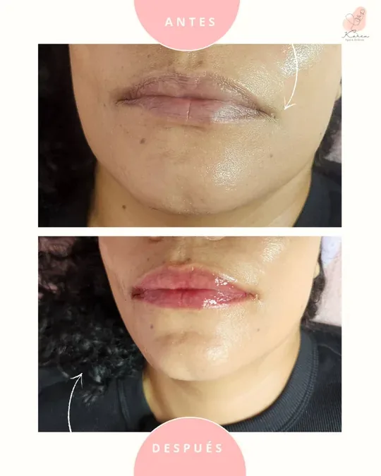 Karen Spa & Belleza · foto 2