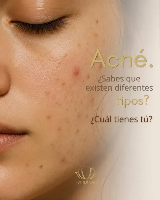 Nymphaea Spa · foto 2