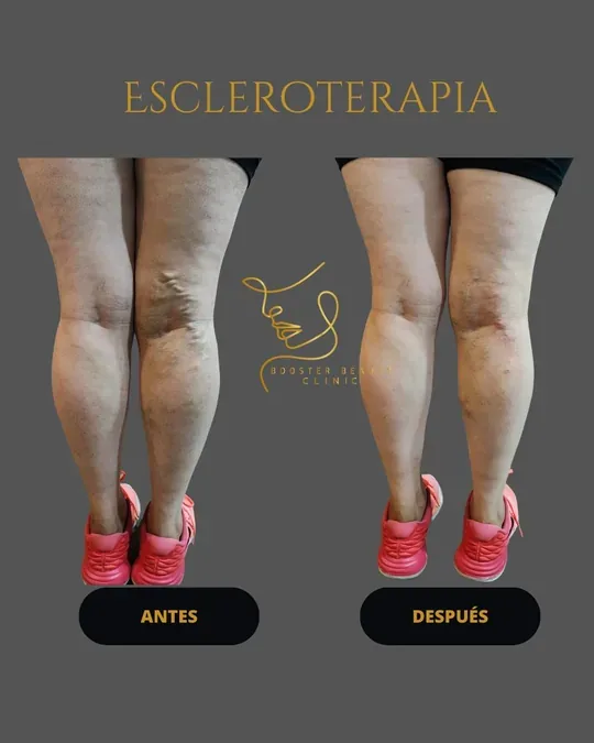 Booster Beauty Clinic · foto 2