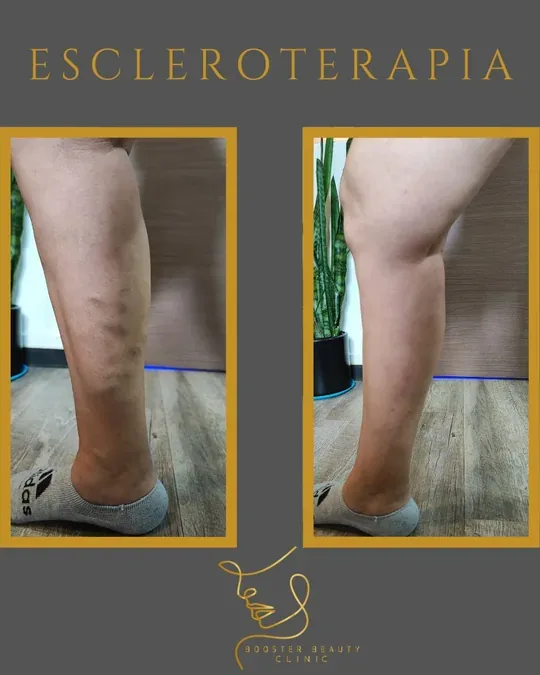 Booster Beauty Clinic · foto 3