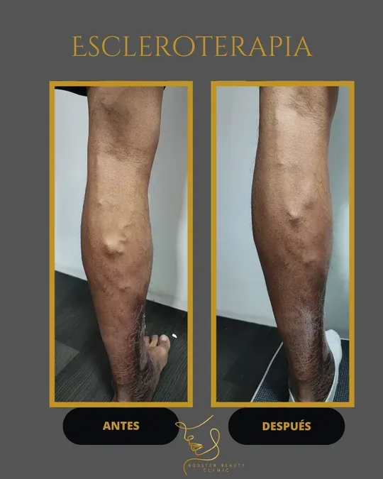 Booster Beauty Clinic · foto 4