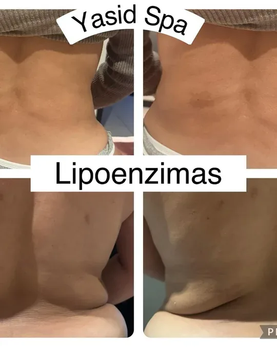 Yasid Spa · foto 4