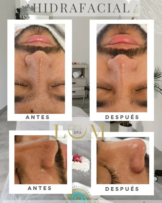 LUM SPA · foto 1