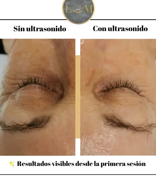LUM SPA · foto 2