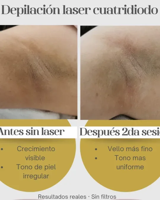 LUM SPA · foto 4
