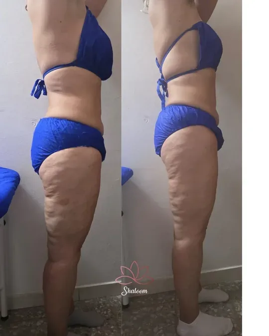 Shaloom spa · foto 1