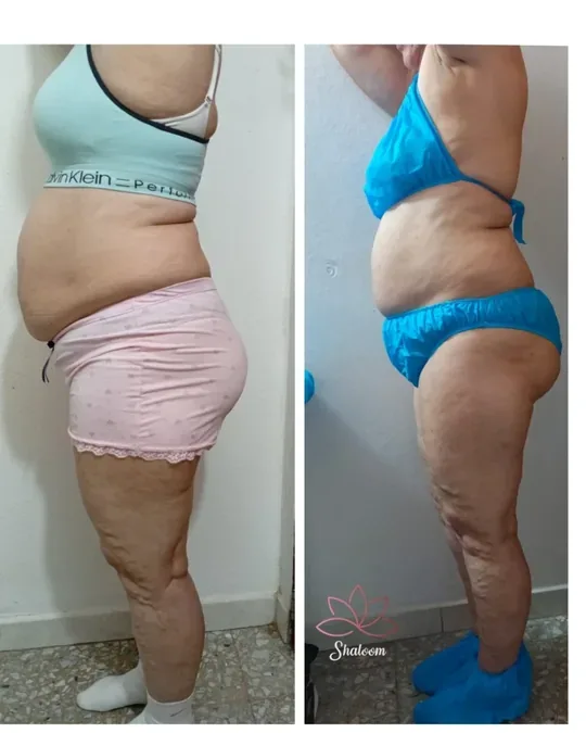 Shaloom spa · foto 2