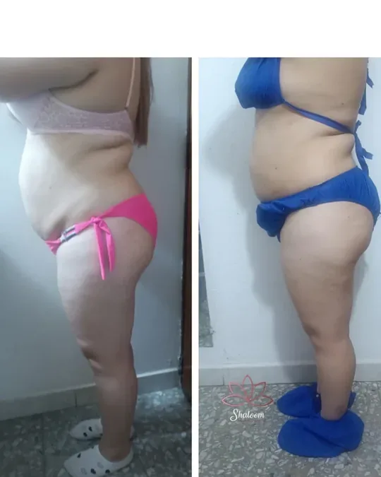 Shaloom spa · foto 4