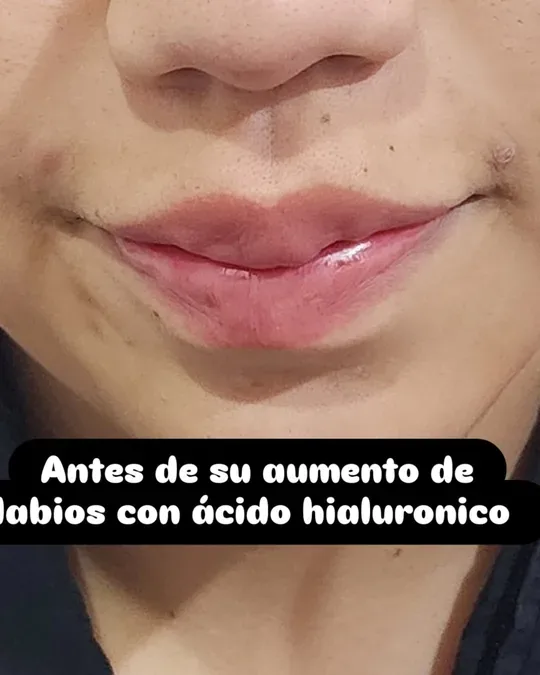 ÁNGEL SPA · foto 1