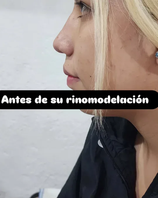 ÁNGEL SPA · foto 2