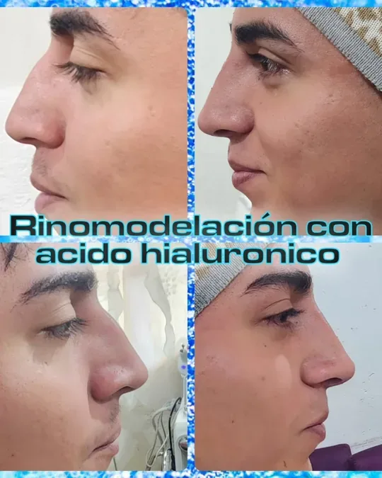 ÁNGEL SPA · foto 3