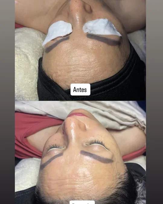 Amarte Spa · foto 2