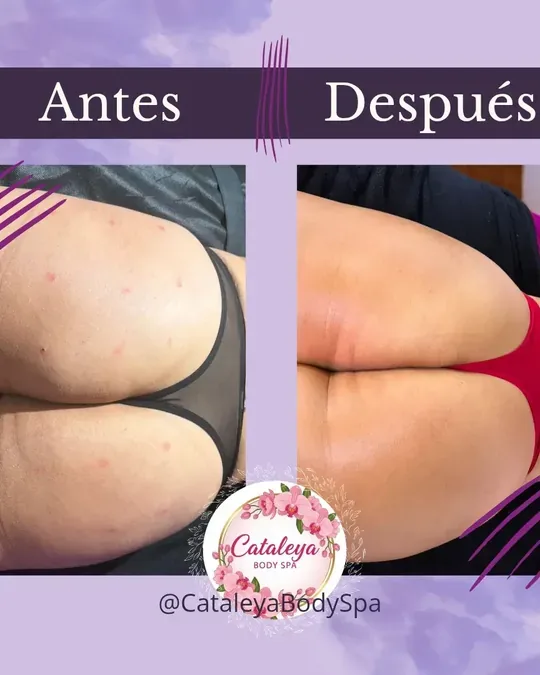 Cataleya Body Spa · foto 1
