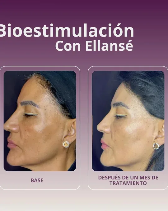 Medicina Estética y Spa «Bleu Clinique» · foto 3