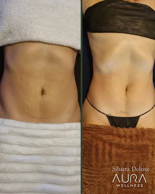 Aura Wellness Colima · foto 2