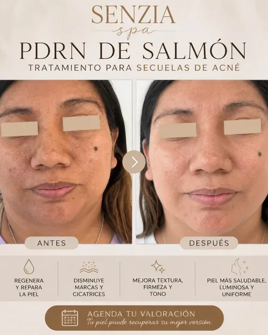SENZIA SPA · foto 2