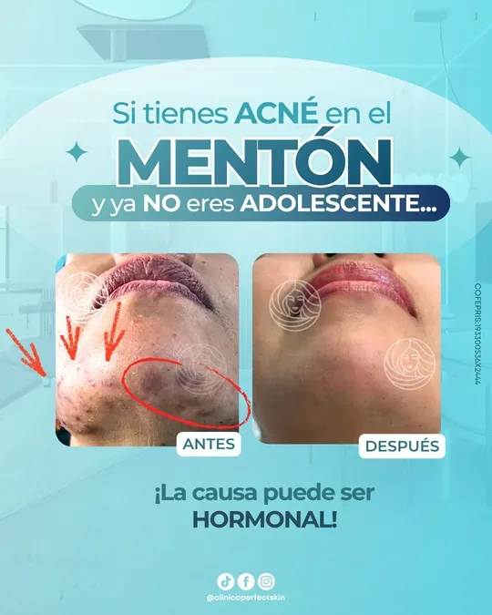 Perfect Skin · foto 4