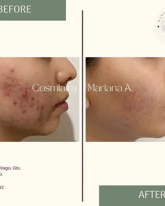 Cosmiatra Mariana Arredondo · foto 1