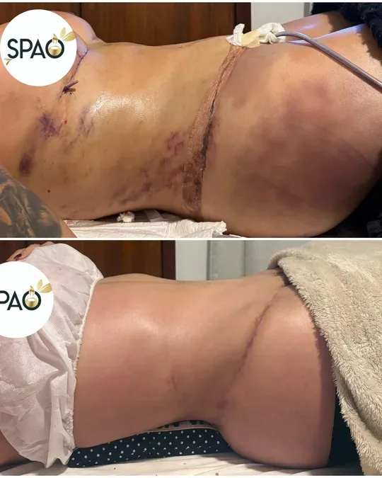 SPAO CASA DE RECUPERACIÓN Y SPA · foto 2