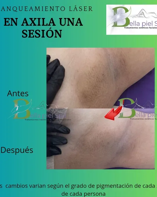 Bella Piel Spa · foto 4