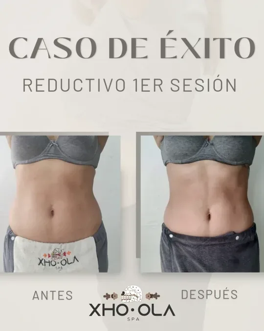 Spa Gdl · foto 2