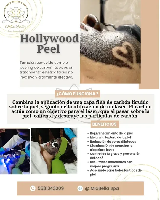 Mia Bella Spa · foto 3