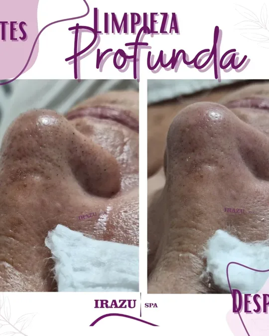 Irazu Spa · foto 2