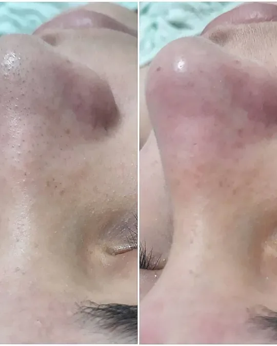 Menta y Canela SPA · foto 2