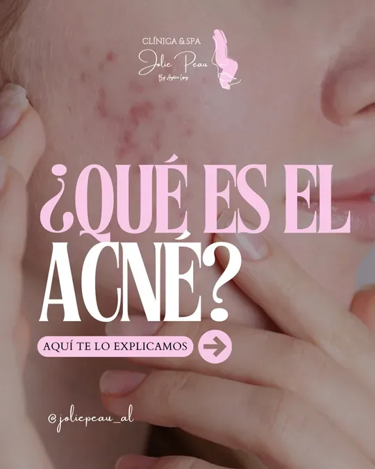 Jolie Peau Clínica & Spa · foto 4