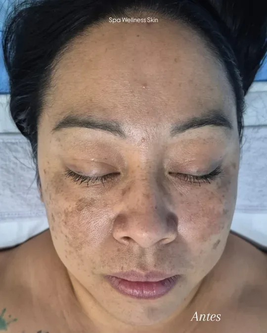 Spa Wellness Skin · foto 2