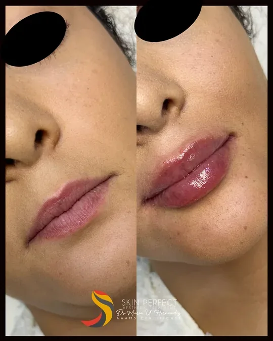 SKIN PERFECT SPA · foto 1