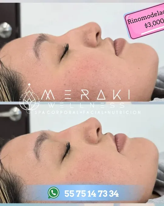 Meraki Wellness spa · foto 3