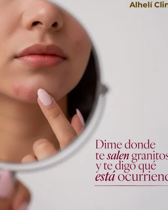 Alhelí Clinique · foto 3