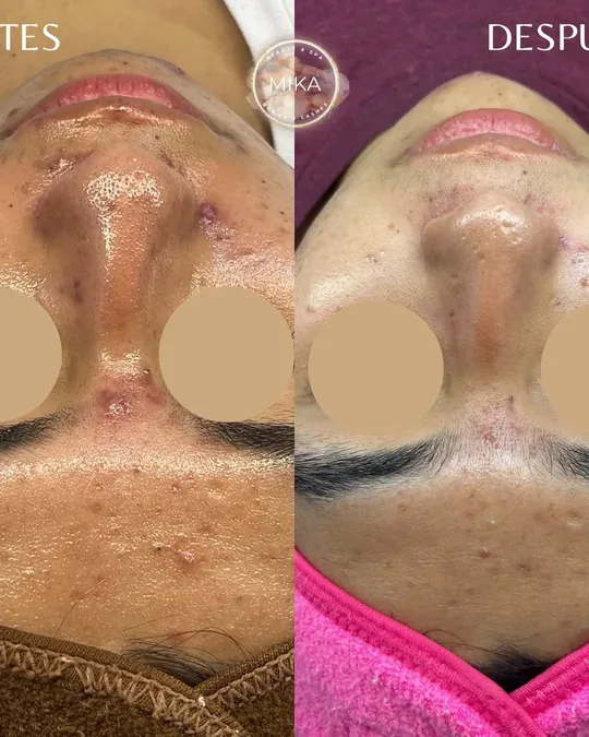 Mika Beauty & Spa · foto 3