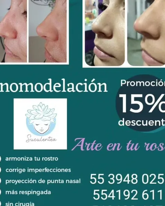 La Suculenta Spa · foto 2
