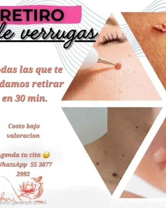 Emmi spa · foto 1