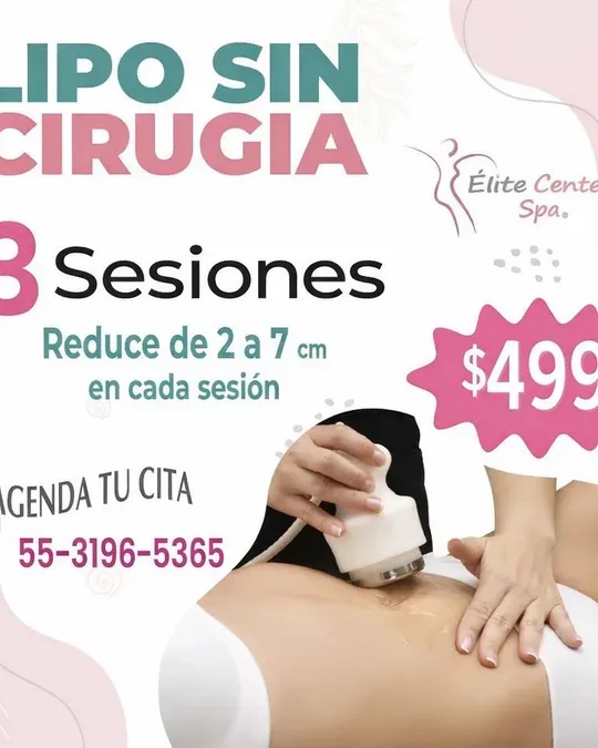 Elite Center Spa · foto 4