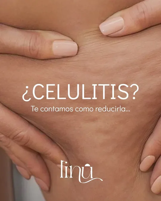 linu spa · foto 4