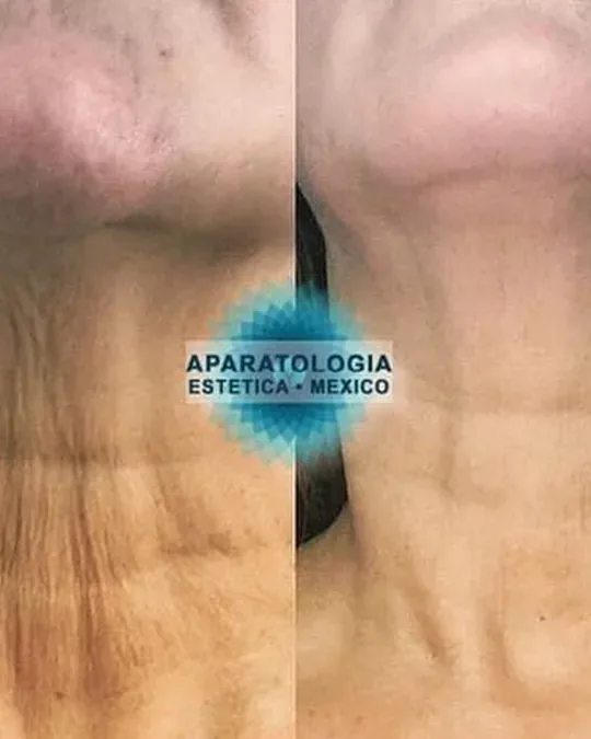 Bastida City Spa · foto 2
