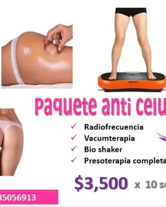 Sbeltex · foto 1