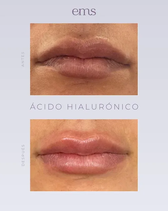 ElectroMedSpa Masajes relajantes y reductivos, faciales, skin care, médicina estetica · foto 1