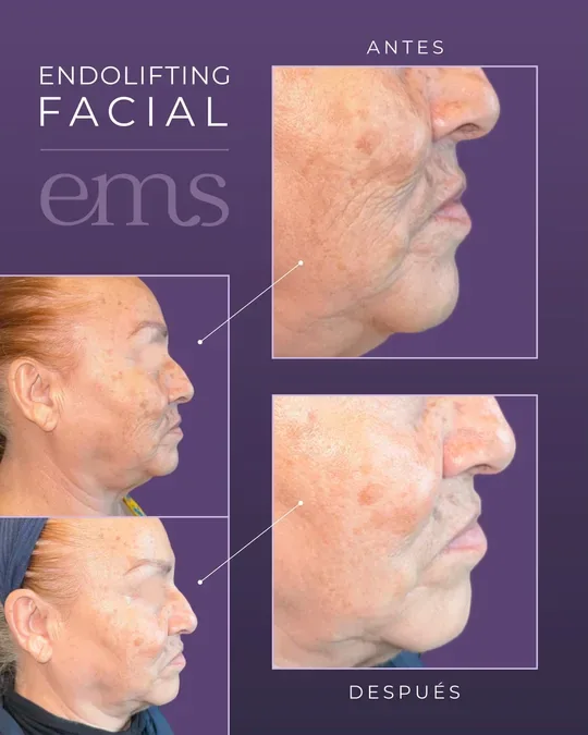 ElectroMedSpa Masajes relajantes y reductivos, faciales, skin care, médicina estetica · foto 4