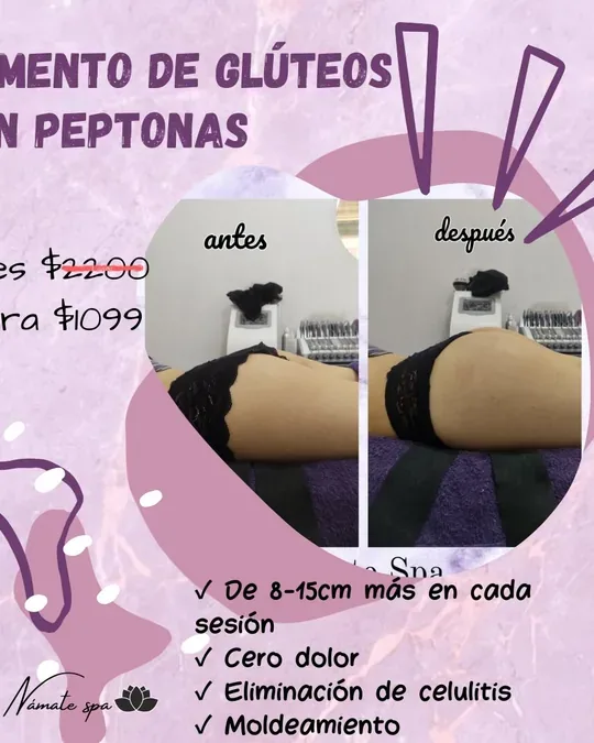 Námate spa · foto 1