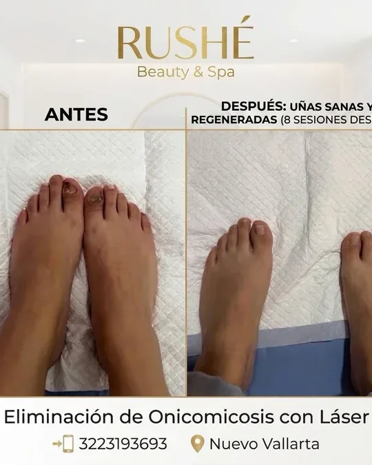 RUSHÉ Beauty & Spa · foto 1
