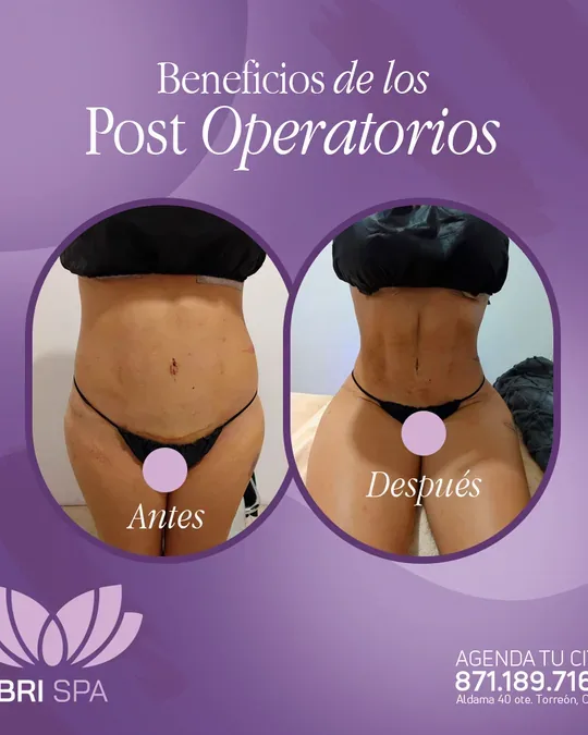 Bri Spa · foto 3