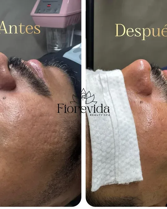 Fiorevida · foto 3