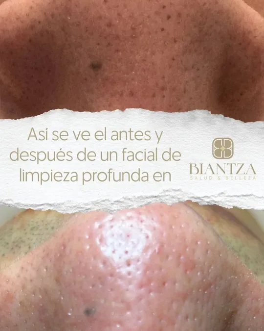 BIANTZA · foto 3