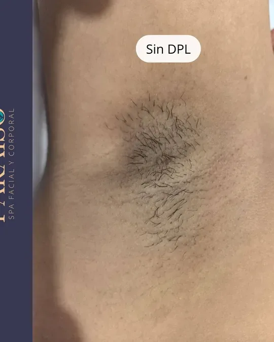 Paraíso SPA · foto 4