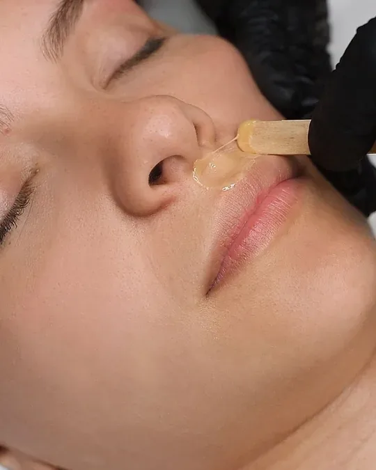 Belladerm · foto 4