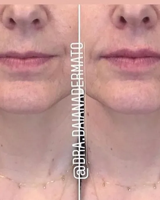 Bella Derm · foto 4